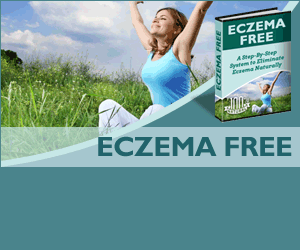 Eczema Free
