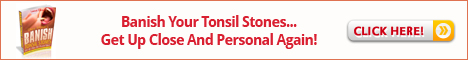 Banish Tonsil Stones