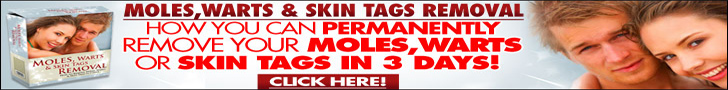 Moles, Warts and Skin Tags Removal
