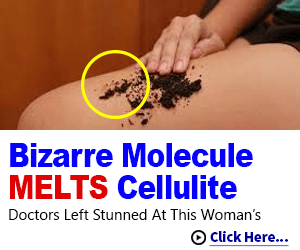 Erase Cellulite