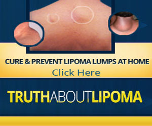 Truth About Lipoma